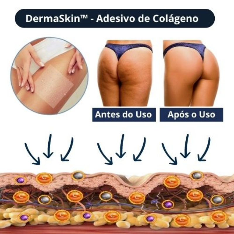 DermaSkin™ Adesivo de Colágeno - Volte a ter uma Pele Linda e Livre de Imperfeições